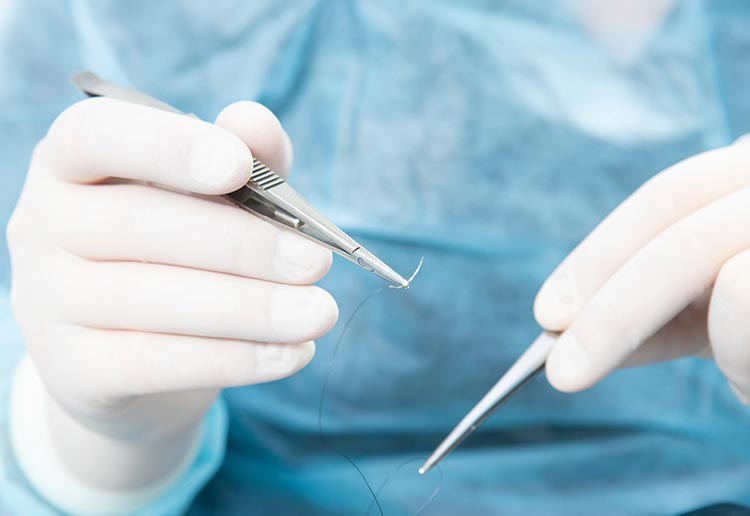 日帰り手術イメージ