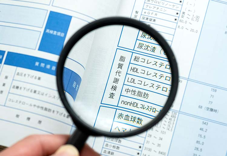 脂質異常症イメージ