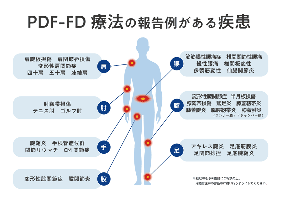 PDF-FD療法の報告例がある疾患