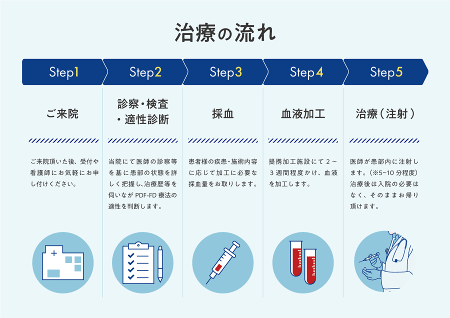治療の流れイメージ